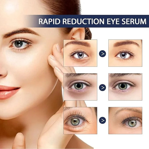 Rapid Reduction Eye Serum - Advanced Formula - Anti Aging Serum Visibly Reduces Under-Eye Bags-q2 - Product Image