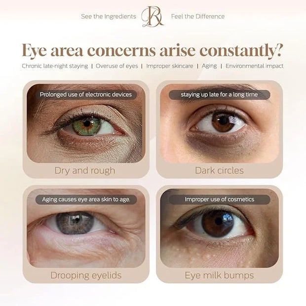 Decoder Eye Puffiness Relief and Repair Beauty Eye Serum Oil, Eye Skin Care Essence Oil, Under Eye Cream - Jojoba Oil, Squ...