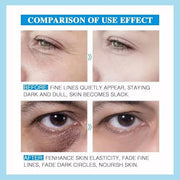 Eye Lift Eye Cream Anti-Wrinkle - Product Image