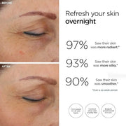 20/20 Eye Cream for Dark Circles and Puffiness | Vegan | Clean | Natural | Cruelty-free | Anti-Aging | Eye Cream for Wrink...