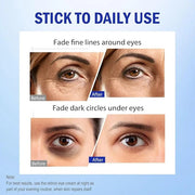 Retinol Eye Cream, Hydrating Under Eye Care Daily Wrinkle Cream, Infused with AHA30% to Smooth and Hydrate Skin, Eye Crea ...