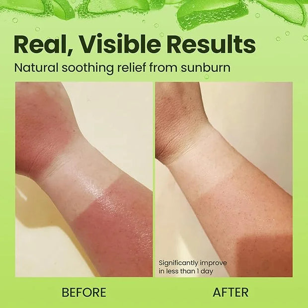 Organic Aloe Vera Gel - 100% Pure for Skin, Sunburn Relief & Face Moisturizer - Extracted from Aloe Vera Plant with Manuka...