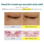 GOODAL Green Tangerine Vitamin C Eye Cream - Dark Circle Relief, Elasticity Treatment, Gentle Anti-Aging & Anti-Wrinkle Ca...