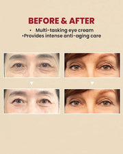 KSECRET SEOUL 1988 Eye Cream : Retinal Liposome 4% + Fermented Bean, 30ml/1.01 fl.oz. - Product Image