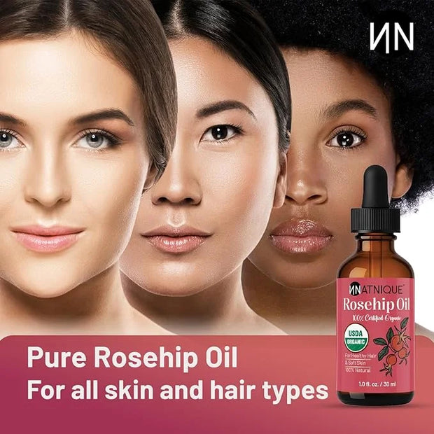 Rosehip Seed Oil Organic 1oz, USDA Certified, 100% Pure Rosehip Oil for Face, Hair & Skin. Cold Pressed Natural Moisturize...