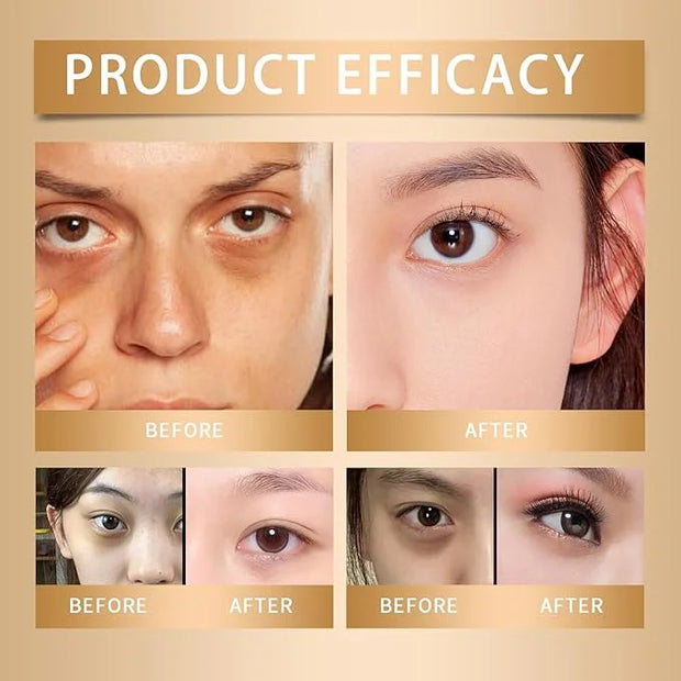Under Eye Corrector SPF 41, Under Eye Cream for Dark Circles, Dark Circles Under Eye Treatment, eye corrector for dark cir...