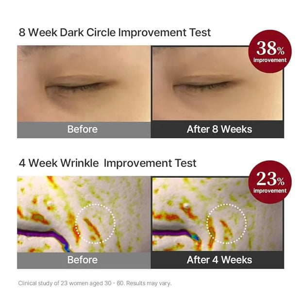 Pregnancy Safe Fermentation Peptine Eye Care Cream Under Eye Cream with 8 Peptides and Niacinamide, Anti Aging Eye Cream f...