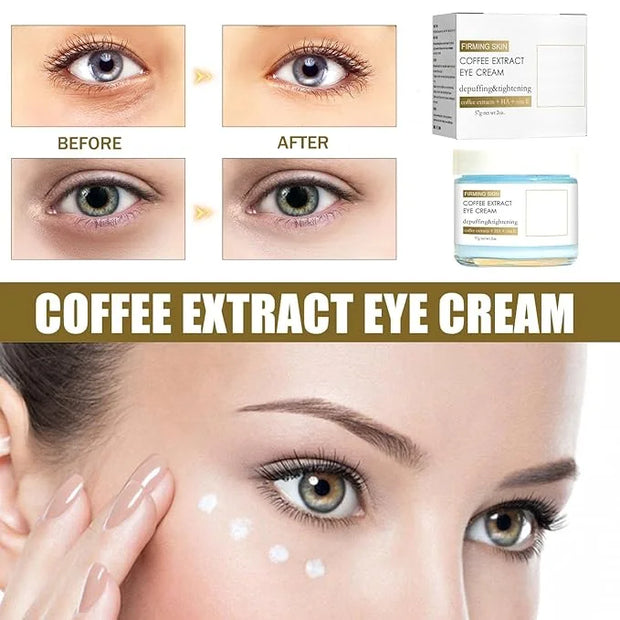 2Pcs Caffeine Eye Cream, Caffeine Eye Cream For Dark Circles And Puffiness, Korean Retinol Fix Eye Cream For Tightening An...