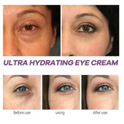Xylane Eye Cream for Dark Circle & Puffiness, Caffeine/Pro-Xilane Active Anti-Wrinkle Eye Cream, Anti-Aging Active Eye Rep...