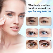 Eye Repair Cream - And Bags Under Eyes,Anti-Aging,Anti-Oxidant,Lightens Fine Lines,Reduces Wrinkles,For Women Under Eye Cr...