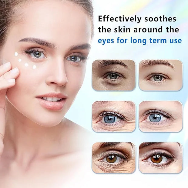 Eye Repair Cream - And Bags Under Eyes,Anti-Aging,Anti-Oxidant,Lightens Fine Lines,Reduces Wrinkles,For Women Under Eye Cr...