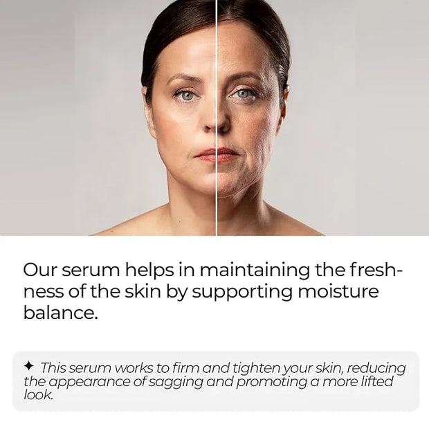 Under Eye Cream for Puffiness & Dark Circles + Argireline & Matrixyl 3000 Serum Bundle - Anti-Aging Eye Cream and Collagen...