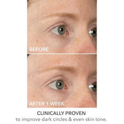Dr Dennis Gross DermInfusions Lift + Repair Eye Mask | Visibily Lift + Firm, Fills the Appearance of Fine Lines, Hydrates ...