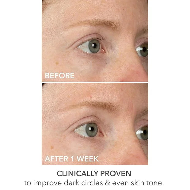 Dr Dennis Gross DermInfusions Lift + Repair Eye Mask | Visibily Lift + Firm, Fills the Appearance of Fine Lines, Hydrates ...