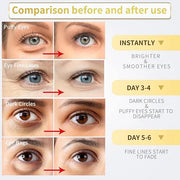 24K Gold Under Eye Patches - 60 Pack for Puffy Eyes, Dark Circles, Bags & Wrinkles with Collagen & Hyaluronic Acid - Produ...