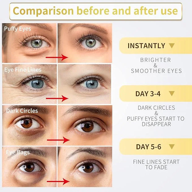 24K Gold Under Eye Patches - 60 Pack for Puffy Eyes, Dark Circles, Bags & Wrinkles with Collagen & Hyaluronic Acid - Produ...