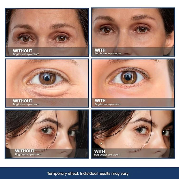 Bag Buster Eye Cream - CPR Repair Eye Cream | Eye Cream for Puffiness and Bags Under Eyes - Product Image