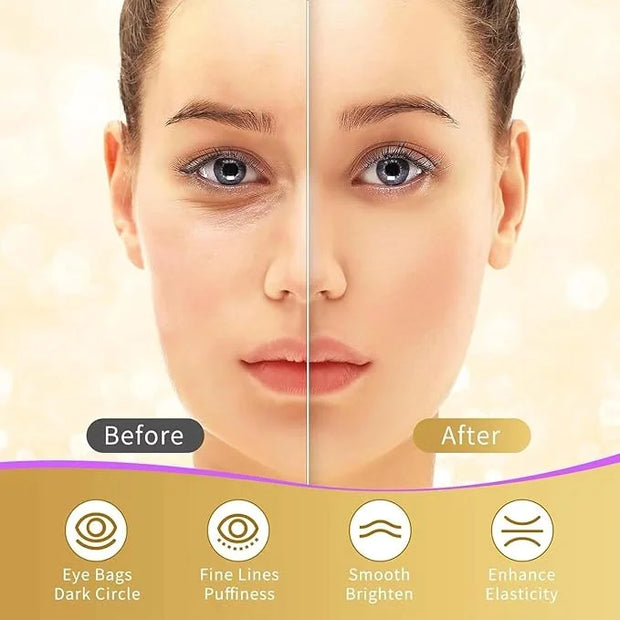 Under Eye Patches, 40 Pairs Eye Mask for Dark Circles, Puffy Eyes, Undereye Bags,Wrinkles,Eye Mask Patches with 24K Gold, ...