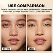 Mineral Sunscreen Eye Cream for Dark Circles,3-in-1 Under Eye Cream Anti Aging for Puffiness and Bags Under Eyes,Under Eye...