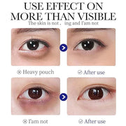 Q.Z.Art Revitalizing Eye Cream with Hyaluronic Acid & Collagen | Hydrates, Includes Soothing Ice Roller - Product Image