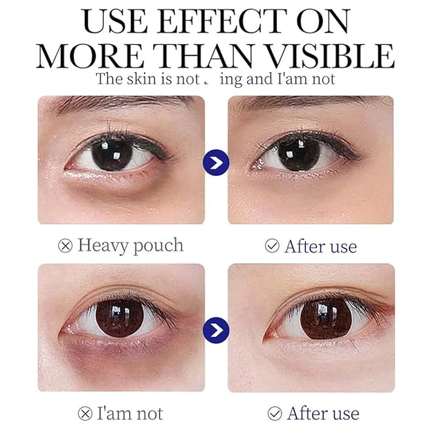 Q.Z.Art Revitalizing Eye Cream with Hyaluronic Acid & Collagen | Hydrates, Includes Soothing Ice Roller - Product Image
