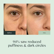 Caffeine Eye Cream for Dark Circles and Puffiness – Moonstone Under Eye Cream with Cooling Tip, Retinol, Hyaluronic Acid &...