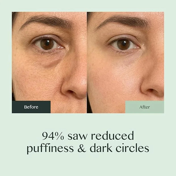Caffeine Eye Cream for Dark Circles and Puffiness – Moonstone Under Eye Cream with Cooling Tip, Retinol, Hyaluronic Acid &...