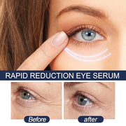 Rapid Reduction Eye Serum - Advanced Formula - Anti Aging Serum Visibly Reduces Under-Eye Bags - Product Image