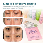 Frownies Under Eye Gel Patches for Puffy Eyes - Dark Circles with Cactus Collagen - Reusable, 3 Pack - Product Image