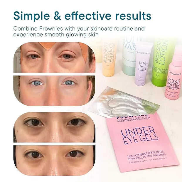 Frownies Under Eye Gel Patches for Puffy Eyes - Dark Circles with Cactus Collagen - Reusable, 3 Pack - Product Image