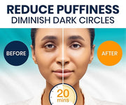 Stylia Under Eye Patches for Puffy Eyes and Dark Circles (12 Pairs) - Marine Collagen Under Eye Mask with Vitamin C, Hyalu...