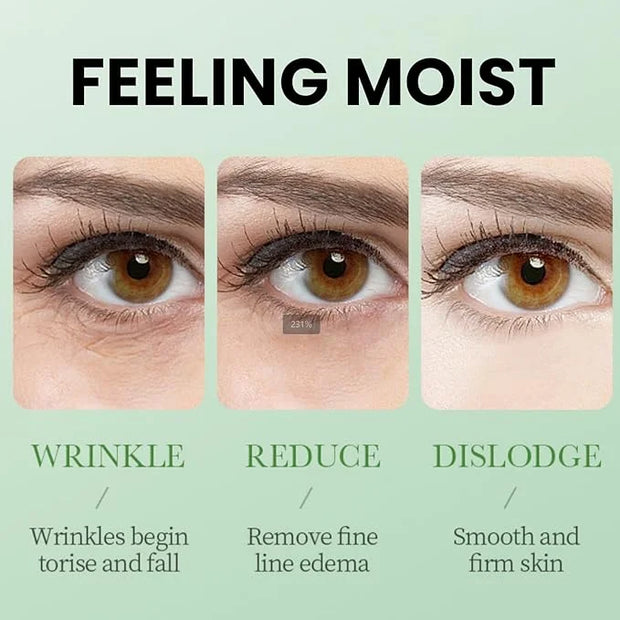 Under Eye Patches for Dark Circles, Puffy Eyes and Dark Circles, Under Eye Mask Dark Circles Under Eye Treatment, Aloe Ver...
