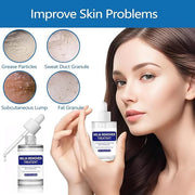 Milia Remover Treatment Serum, Milia Remover for Eyes & Face，Deep Clear to Get Glow Skin 0.85 oz - Product Image