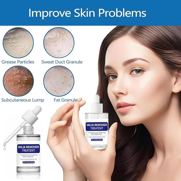 Milia Remover Treatment Serum, Milia Remover for Eyes & Face，Deep Clear to Get Glow Skin 0.85 oz - Product Image