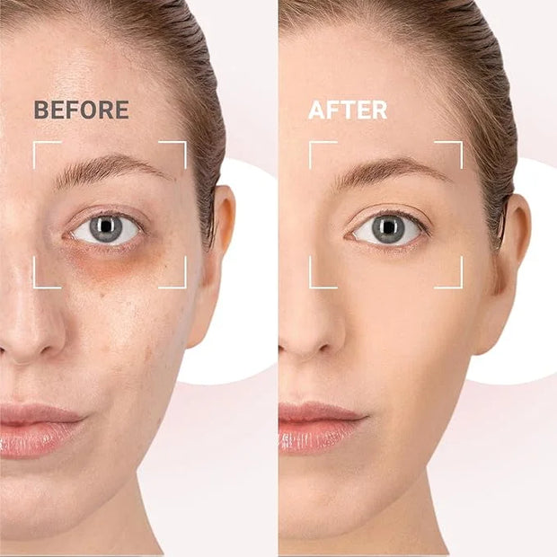Caffeine Eye Cream for Dark Circles and Puffiness,Under Eye Cream for Fine Lines Wrinkles and Bags,Eye Care Eye Roller Ser...