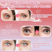Rose Eye Patches 2-Pack (120 PCS), Hydrating & Soothing Eye Mask Skincare, Anti-Aging Collagen Eye Gel, Under Eye Patches ...