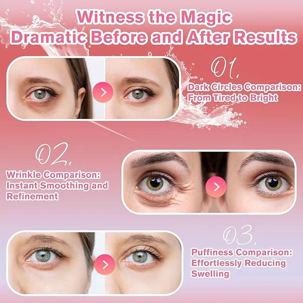 Rose Eye Patches 2-Pack (120 PCS), Hydrating & Soothing Eye Mask Skincare, Anti-Aging Collagen Eye Gel, Under Eye Patches ...