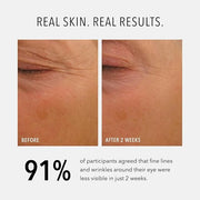 HydroPeptide Eye Authority, Brightens and Helps Restore Radiance to Tired Looking Eyes, 0.5 Ounce - Product Image
