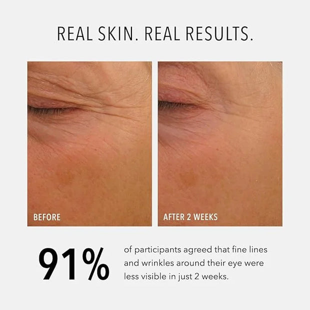 HydroPeptide Eye Authority, Brightens and Helps Restore Radiance to Tired Looking Eyes, 0.5 Ounce - Product Image