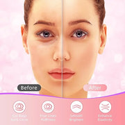 Under Eye Patches, 40 Pairs Eye Mask for Dark Circles, Puffy Eyes, Undereye Bags,Wrinkles,Eye Mask Patches with Rose, Eye ...