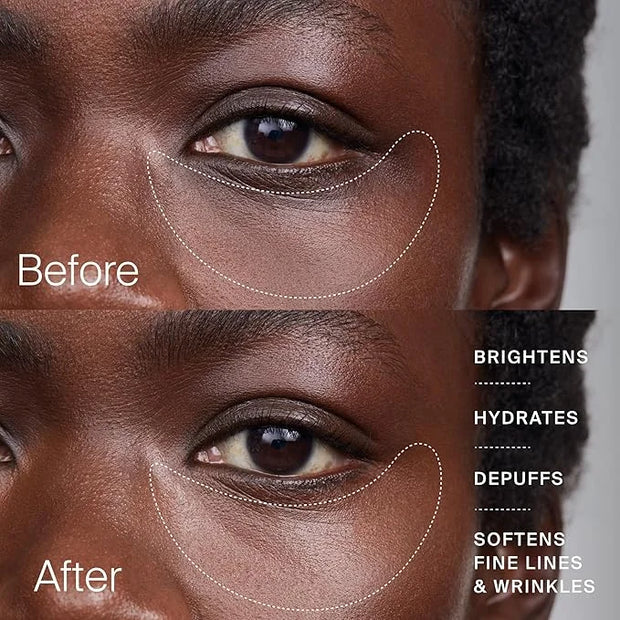 Timeline The Eye Cream - Anti-Aging Cream for Wrinkles, Dark Circles & Under Eye Bags with Urolithin A & Niacinamide (15 m...