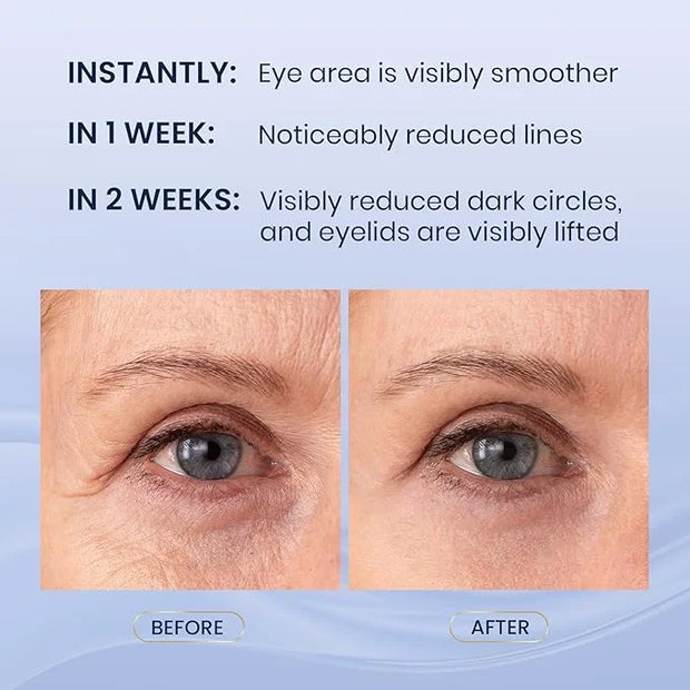 Dual Eye Cream with Advanced Retinol, Peptides, Caffeine for Puffy Eyes and Dark Circles, Wrinkles, Anti Aging, Under Eye ...