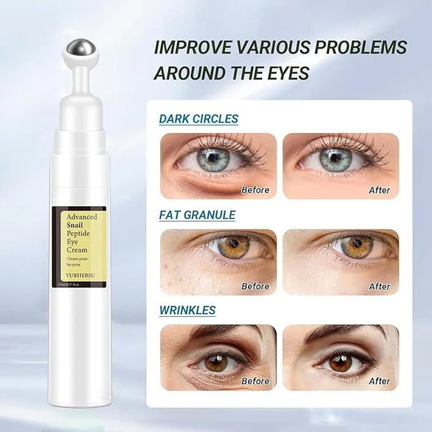 Snail Peptide Under Eye Cream with 73% Snail Mucin & 2% Nicotinamide for Dark Circles, Puffiness & Wrinkles, with 360° Mas...