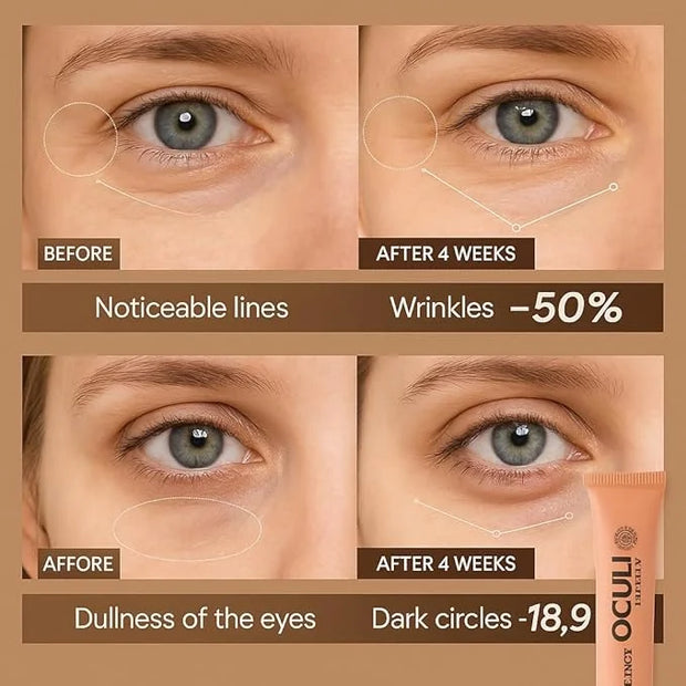 DR. TAGY Under Eye Cream – Dark Circle & Puffiness Treatment – Hydrating & Rejuvenating Formula with Alpha-Arbutin, Vitami...