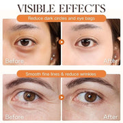2PCS Retinol Eye Stick - Retinol Eye Cream Anti Aging - Under Eye Cream for Da rk Circles - Serum for Puffiness and Bags u...