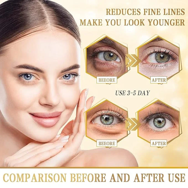 Danvisit 60 Pcs Under Eye Patches: 24K Gold Eye Masks for Dark Circles and Puffiness Anti-Aging & Rejuvenating Hydrogel Ey...