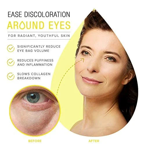 Extreme Dark Circle Serum - Under Eye Treatment for Dark Circles, Puffiness, Wrinkles & Fine Lines - Revitalizing, Anti-Ag...