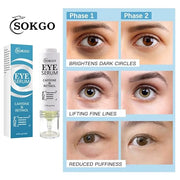 Caffeine Eye Serum, Retinol Eye Firming Serum for Dark Circles and Puffiness, Anti Aging Eye Serum with Hyaluronic Vitamin...