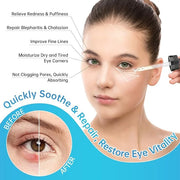 Eye Serum For Chalazion & Blepharitis Treatment, 2 PCS Chalazion Remover For Eyelid Treatment, Eyelid Serum With Avocado O...