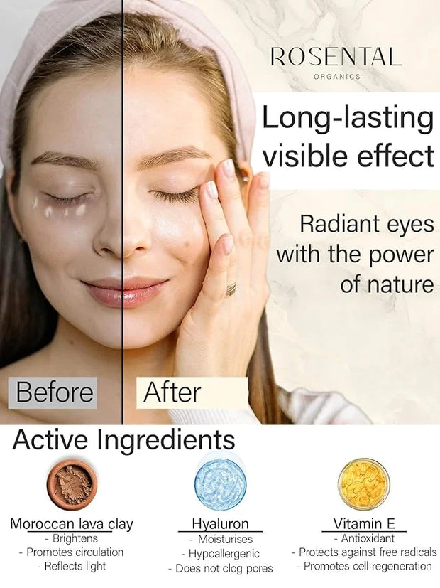 Organics Organic Eye Cream for All Skin Types, 15ml (0.5 fl. oz) (BB Eye Cream, 15ml) - Product Image